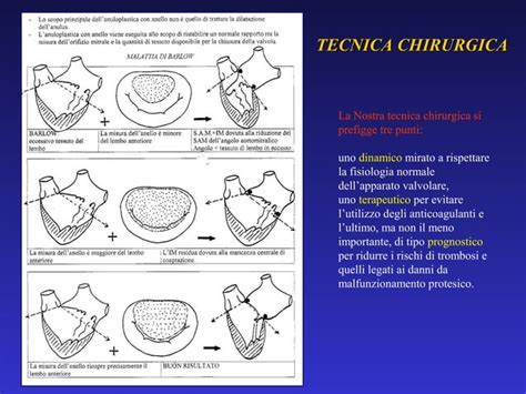 Schema illustrativo della tecnica chirurgica T.O.T.