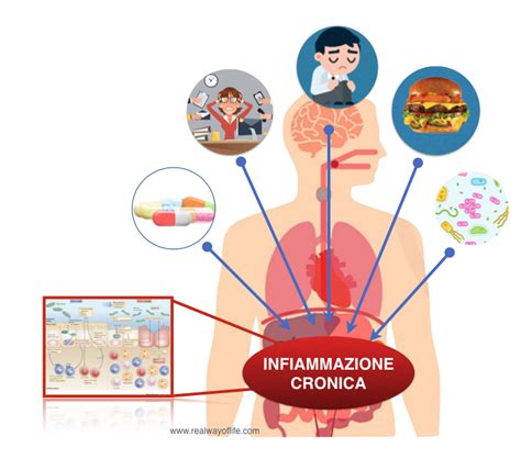 Schema che illustra la correlazione tra infiammazione intestinale e infiammazione cerebrale