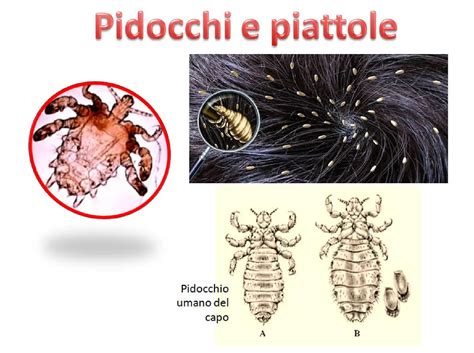 Schema anatomico del pidocchio e delle sue uova (lendini)