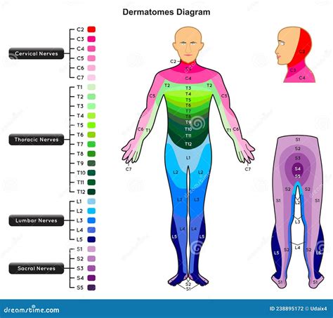 diagramma delle aree del corpo interessate dalla disprassia