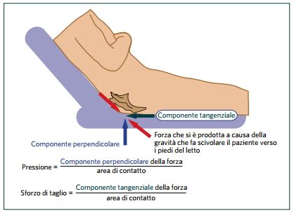 Diagramma che illustra le forze di pressione, attrito e taglio sulla pelle