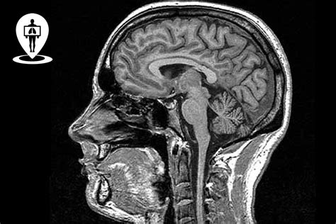 Immagine di una Risonanza Magnetica (RMN) cerebrale