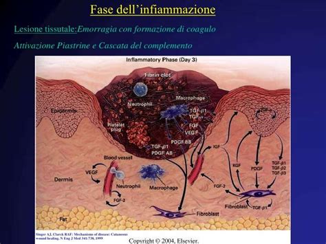 Esempio di tessuto necrotico e fibrinoso in una ferita cronica