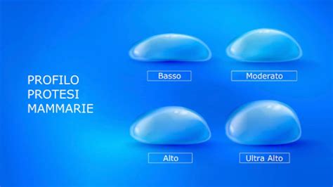 Showroom Dietisan con esposizione di protesi mammarie