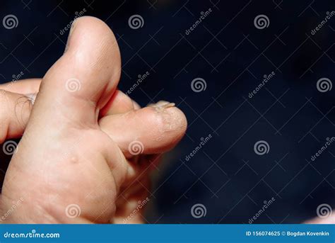 Immagine ravvicinata di unghie fragili