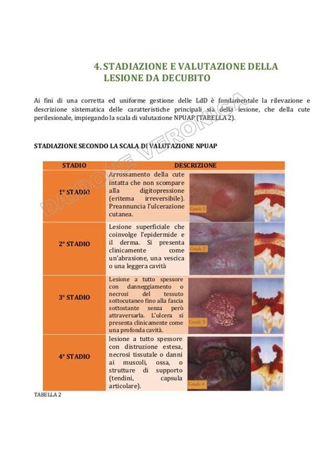 schema fattori di rischio lesioni da decubito