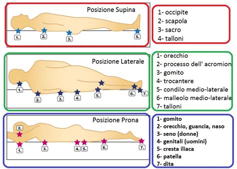 Schema di posizionamento laterale corretto per prevenire le ulcere da pressione