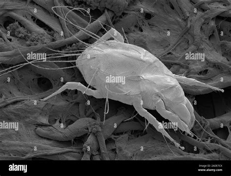 Immagine al microscopio di un acaro della scabbia