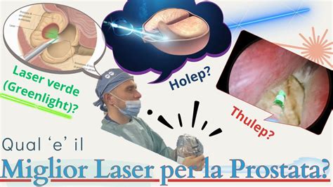 Laser per l'enucleazione prostatica