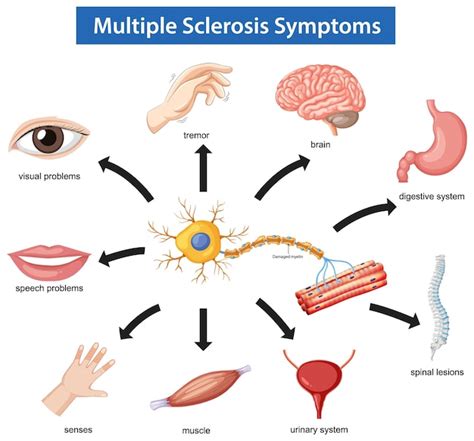 Diagramma che illustra la varietà dei sintomi della ME/CFS