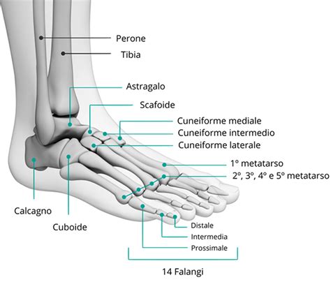 Diagramma anatomico del piede con indicazione di piede valgo ed equino